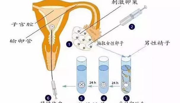 试管取卵多久，全面解析试管婴儿取卵过程与时间
