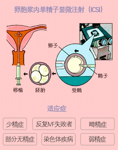 取卵第五天胚胎质量评估与观察