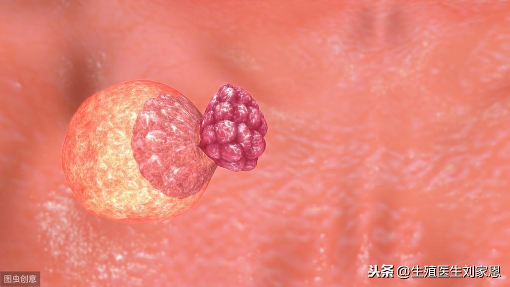 探究取卵后腹水的成因