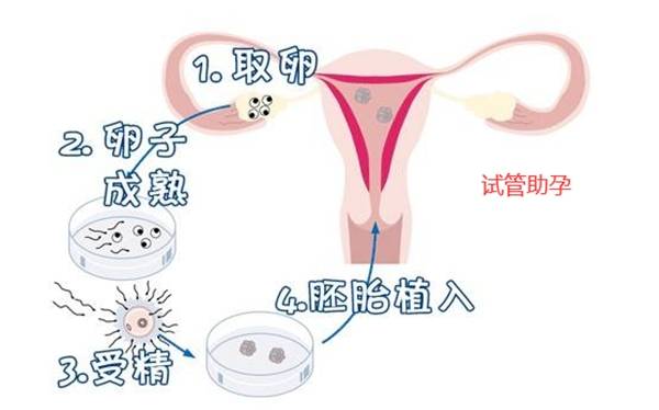 试管婴儿技术中取卵时间的探究，月经后多久取卵最佳？