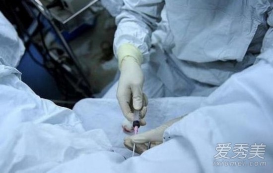 试管婴儿取卵过程，疼痛与否的探讨