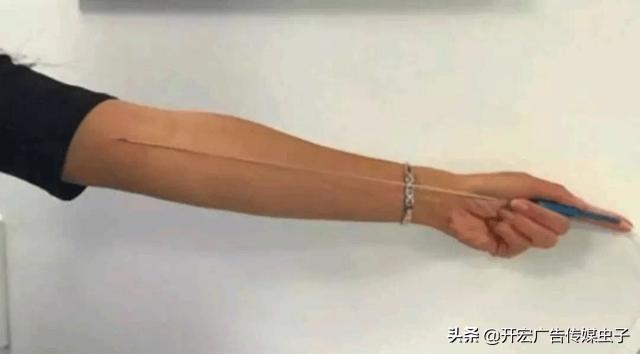 微刺激下卵泡发育与取卵时机的研究